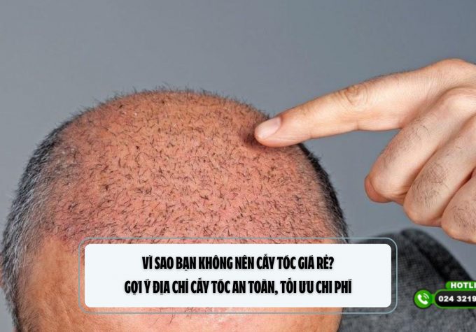 Vì sao bạn không nên cấy tóc giá rẻ? Gợi ý địa chỉ cấy tóc an toàn, tối ưu chi phí 