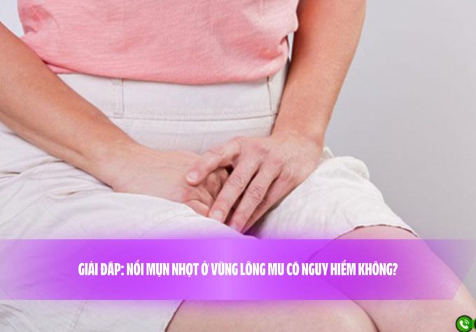 Giải đáp: Nổi mụn nhọt ở vùng lông mu có nguy hiểm không?
