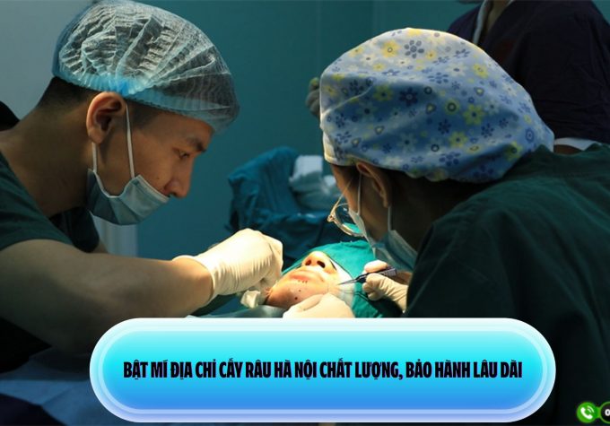 Bật mí địa chỉ cấy râu Hà Nội chất lượng, bảo hành lâu dài