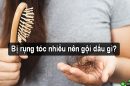 Góc tư vấn: Bị rụng tóc nhiều nên gội dầu gì?