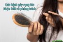Các bệnh gây rụng tóc: Nhận biết và phòng tránh