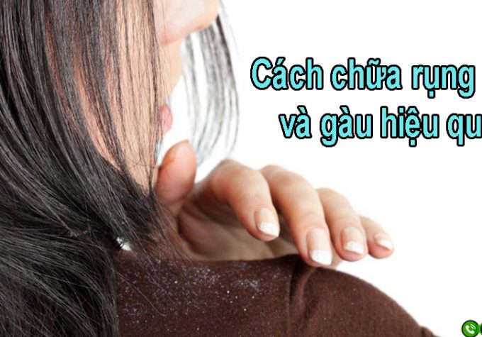 Mách bạn cách chữa rụng tóc và gàu tốt nhất hiện nay