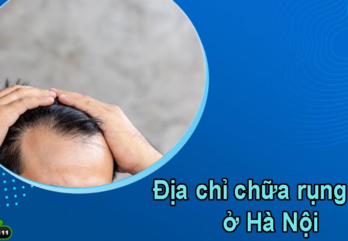 Top 5 địa chỉ chữa rụng tóc ở Hà Nội uy tín và chất lượng!