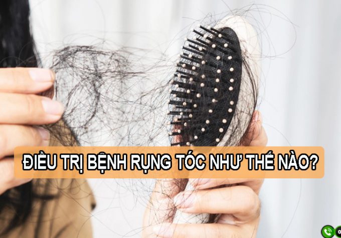 Điều trị bệnh rụng tóc như thế nào hiệu quả?