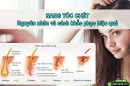 Nang tóc chết : Nguyên nhân và cách phục hồi hiệu quả