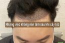 [LƯU Ý] : Những việc không nên làm sau khi cấy tóc