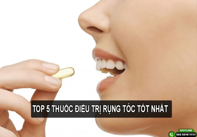 Top 5 loại thuốc điều trị rụng tóc và giúp mọc tóc hiệu quả