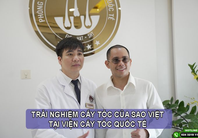 Trải nghiệm cấy tóc của sao Việt – Sự thay đổi khiến ai cũng phải trầm trồ