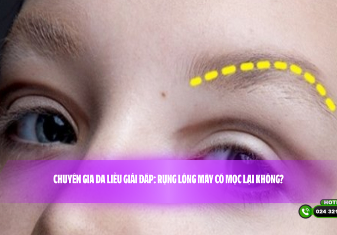 Chuyên gia da liễu giải đáp: Rụng lông mày có mọc lại không?