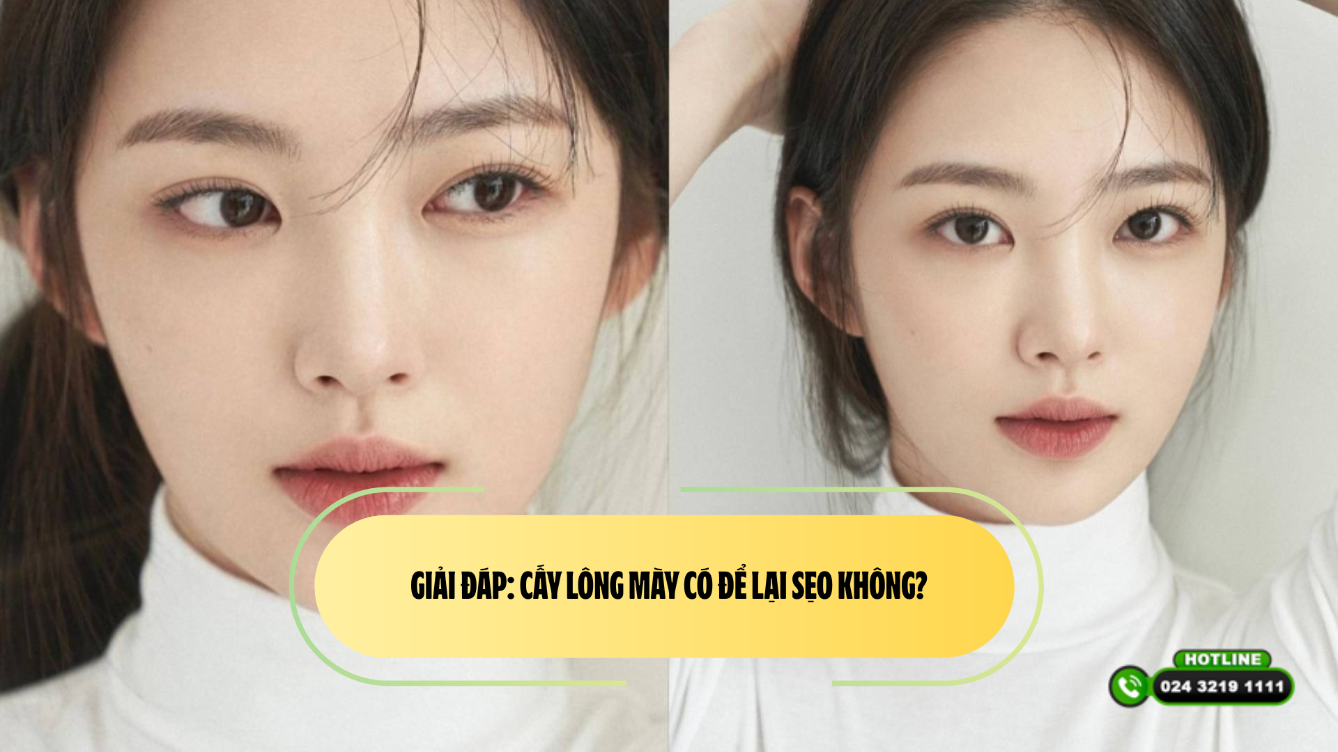 Giải đáp: Cấy lông mày có để lại sẹo không?