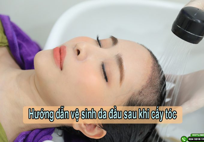 Hướng dẫn cách vệ sinh da đầu sau khi cấy tóc
