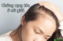 Chứng rụng tóc ở nữ giới: Những điều bạn nên biết