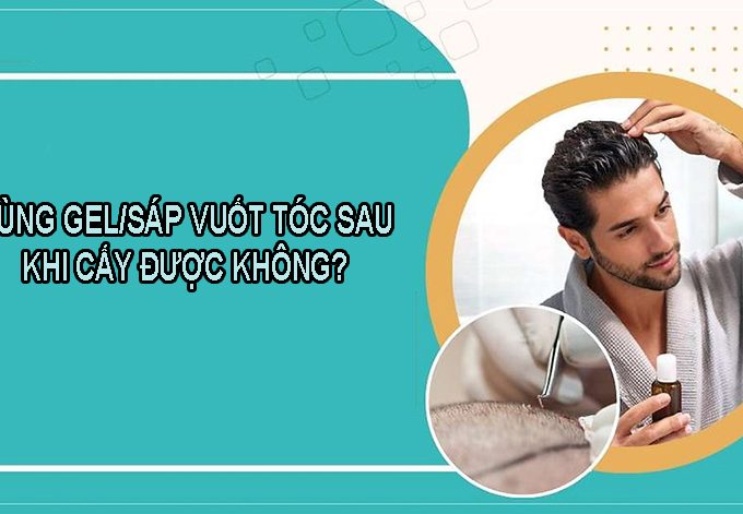 Giải đáp: Dùng gel/sáp vuốt tóc sau khi cấy tóc được không?