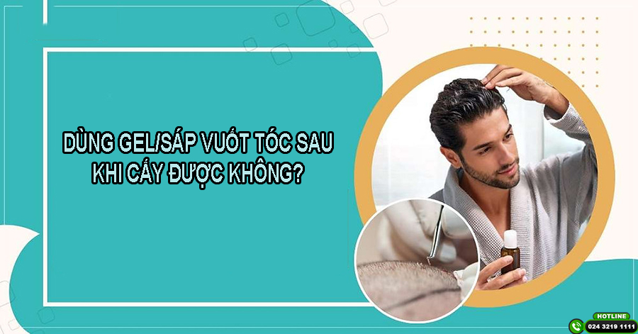 Giải đáp: Dùng gel/sáp vuốt tóc sau khi cấy tóc được không?