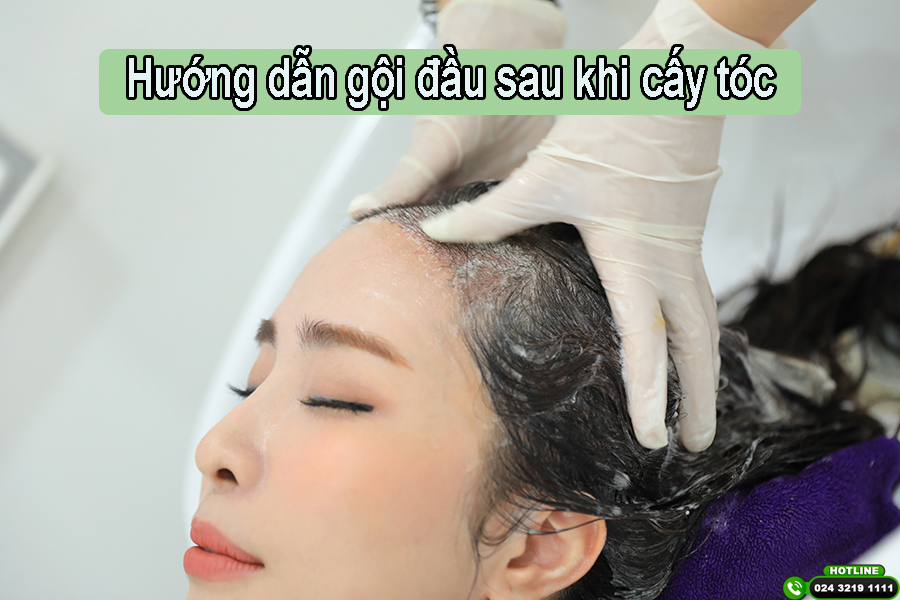 Hướng dẫn gội đầu sau khi cấy tóc chi tiết