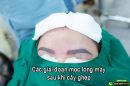 Tìm hiểu các giai đoạn mọc lông mày sau cấy ghép
