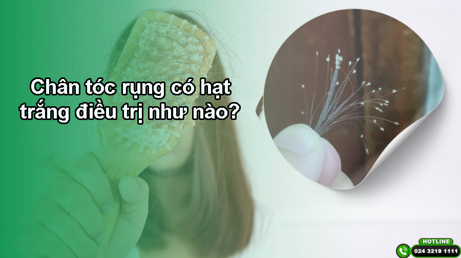 Chân tóc rụng có hạt trắng điều trị như thế nào?