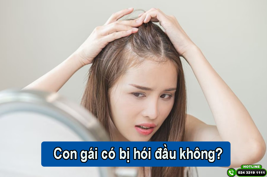Con gái có bị hói đầu không? Cách phòng tránh và khắc phục hiệu quả
