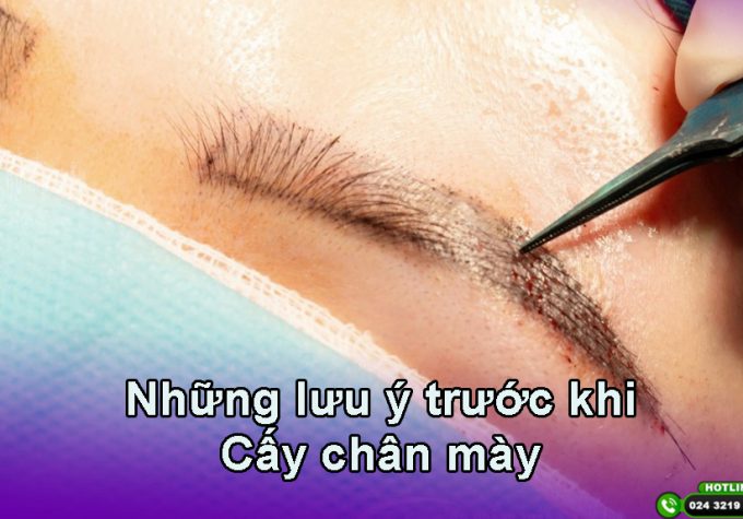 Chuyên gia chia sẻ những điều cần lưu ý trước khi cấy chân mày