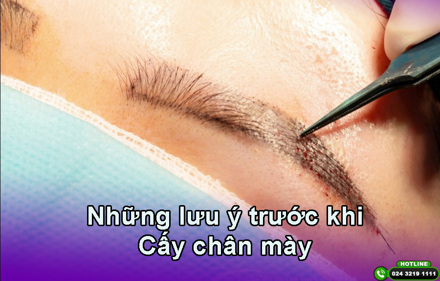 Chuyên gia chia sẻ những điều cần lưu ý trước khi cấy chân mày