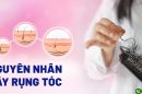 Điểm mặt những nguyên nhân gây rụng tóc phổ biến hiện nay