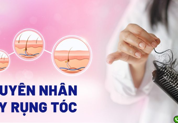 Điểm mặt những nguyên nhân gây rụng tóc phổ biến hiện nay