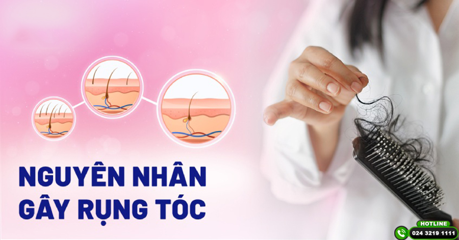 Điểm mặt những nguyên nhân gây rụng tóc phổ biến hiện nay