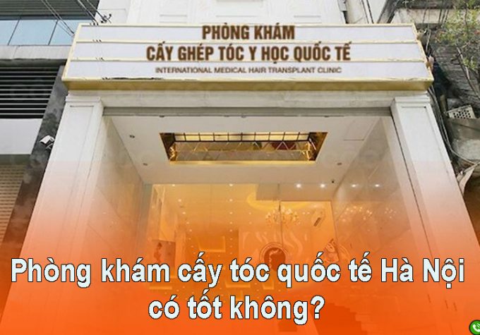 Đánh giá Phòng khám Cấy tóc Quốc tế Hà Nội có tốt không?