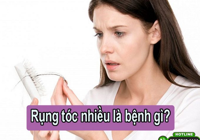 Rụng tóc là mắc bệnh gì? Những điều cần biết!