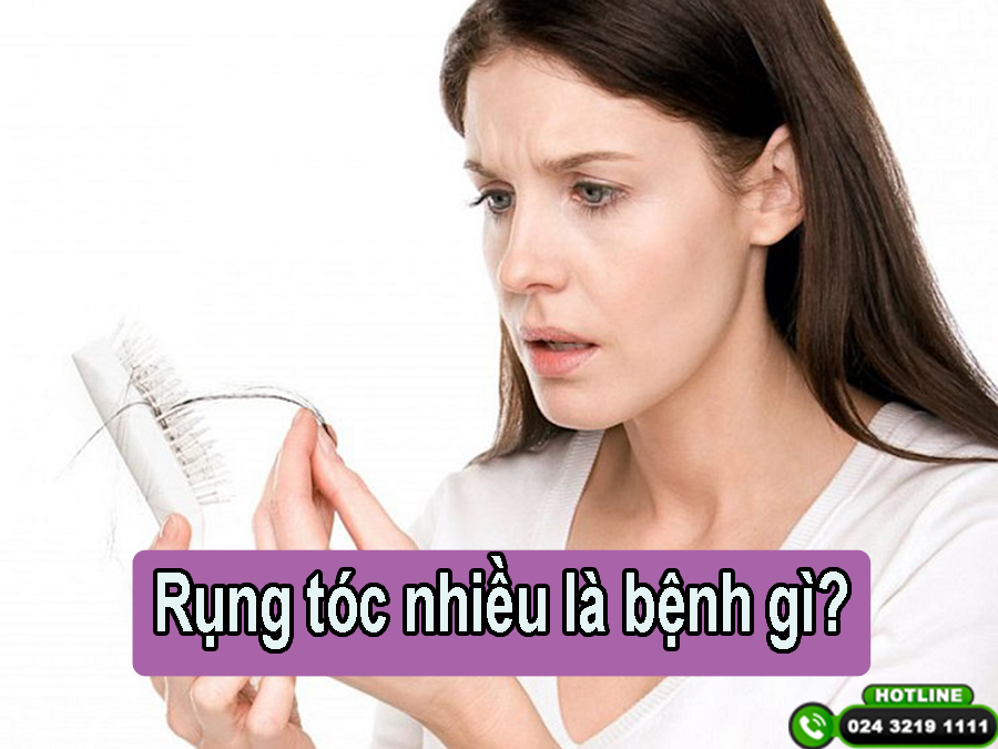 Rụng tóc là mắc bệnh gì? Những điều cần biết!