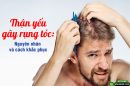 Tại sao thận yếu dẫn đến rụng tóc? Cách khắc phục hiệu quả