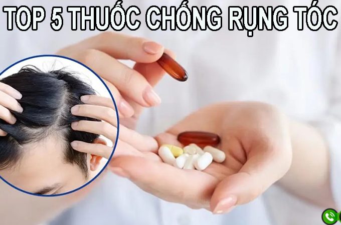 Loại thuốc gì chống rụng tóc? Top 5 sản phẩm được ưa chuộng hiện nay