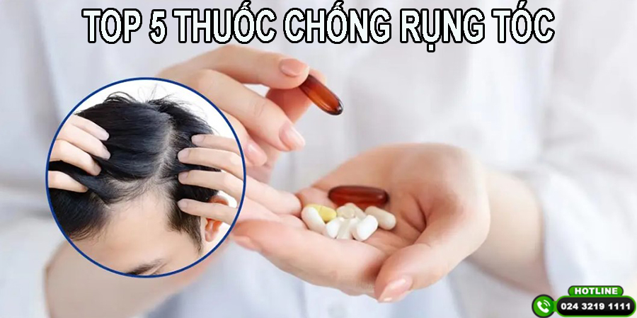 Loại thuốc gì chống rụng tóc? Top 5 sản phẩm được ưa chuộng hiện nay