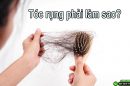 Tóc rụng phải làm sao? Những giải pháp khắc phục hiệu quả