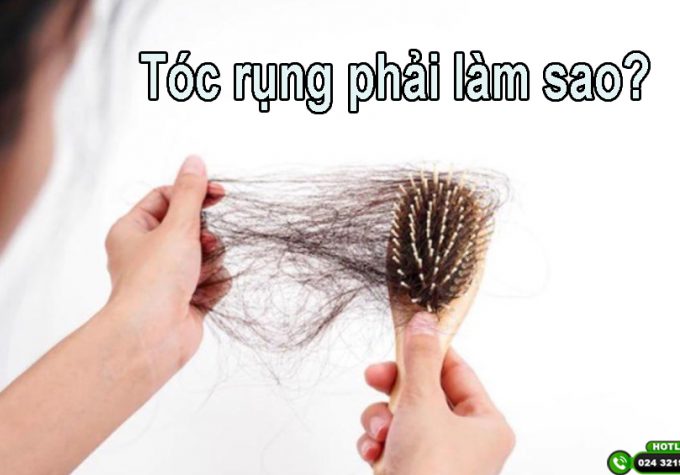 Tóc rụng phải làm sao? Những giải pháp khắc phục hiệu quả