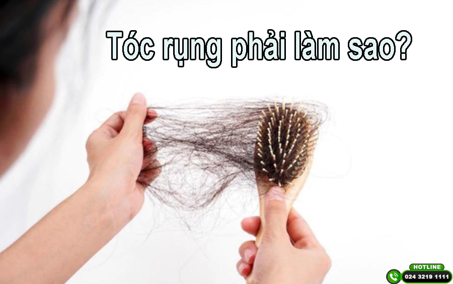 Tóc rụng phải làm sao? Những giải pháp khắc phục hiệu quả