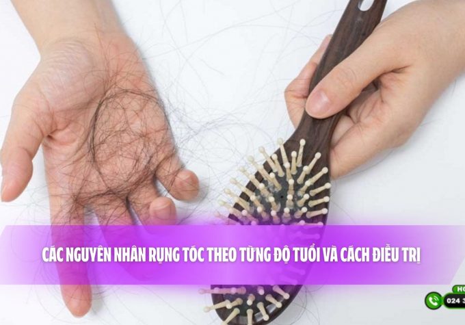 Các nguyên nhân rụng tóc theo từng độ tuổi và cách điều trị 