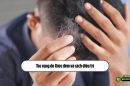 [Tìm hiểu] Tóc rụng do thức đêm và cách điều trị