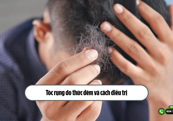 [Tìm hiểu] Tóc rụng do thức đêm và cách điều trị