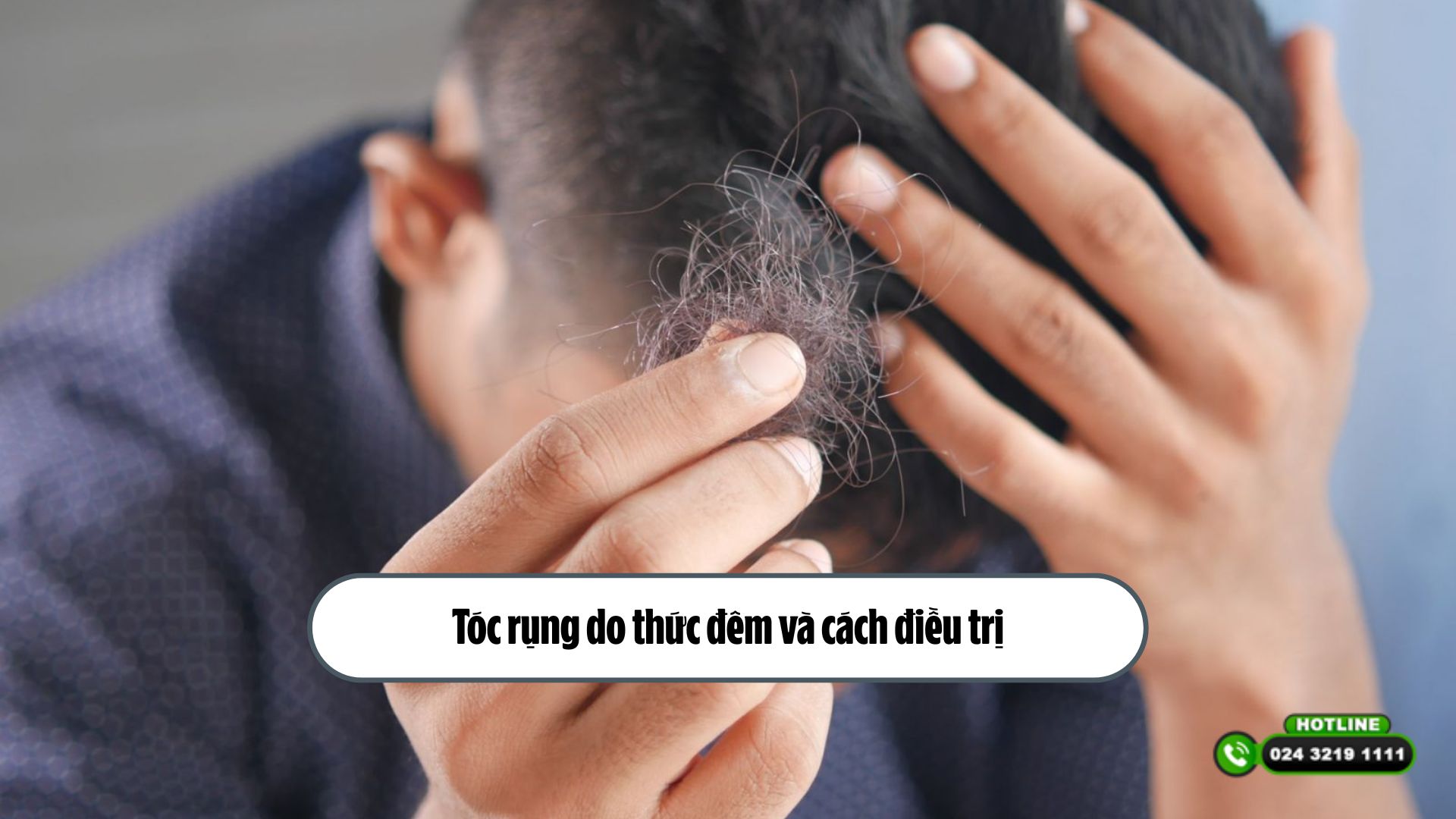 [Tìm hiểu] Tóc rụng do thức đêm và cách điều trị