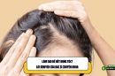 Làm sao để hết rụng tóc? Lời khuyên của bác sĩ chuyên khoa 