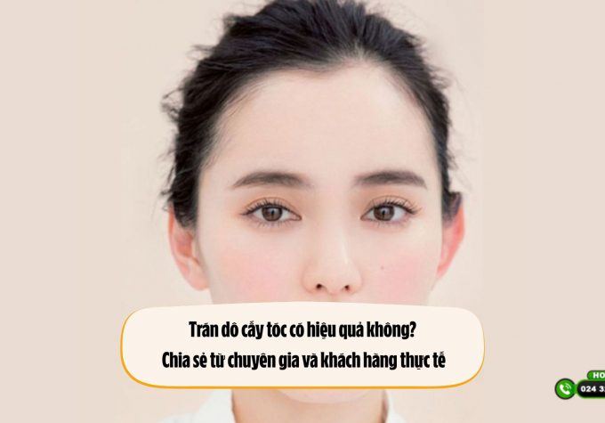 Trán dô cấy tóc có hiệu quả không? Chia sẻ từ chuyên gia và khách hàng thực tế