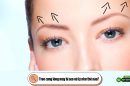 Treo cung lông mày bị sẹo xử lý như thế nào?