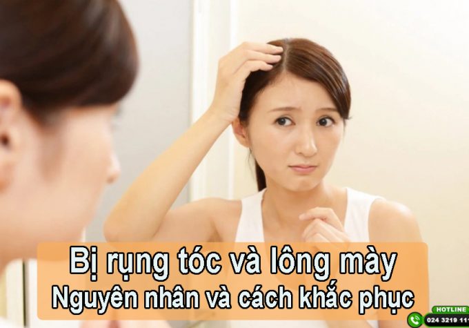 Bị rụng tóc và lông mày: Nguyên nhân và cách điều trị