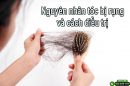 Nguyên nhân tóc bị rụng và cách điều trị – Bạn đã biết!
