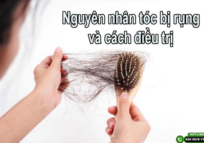 Nguyên nhân tóc bị rụng và cách điều trị – Bạn đã biết!