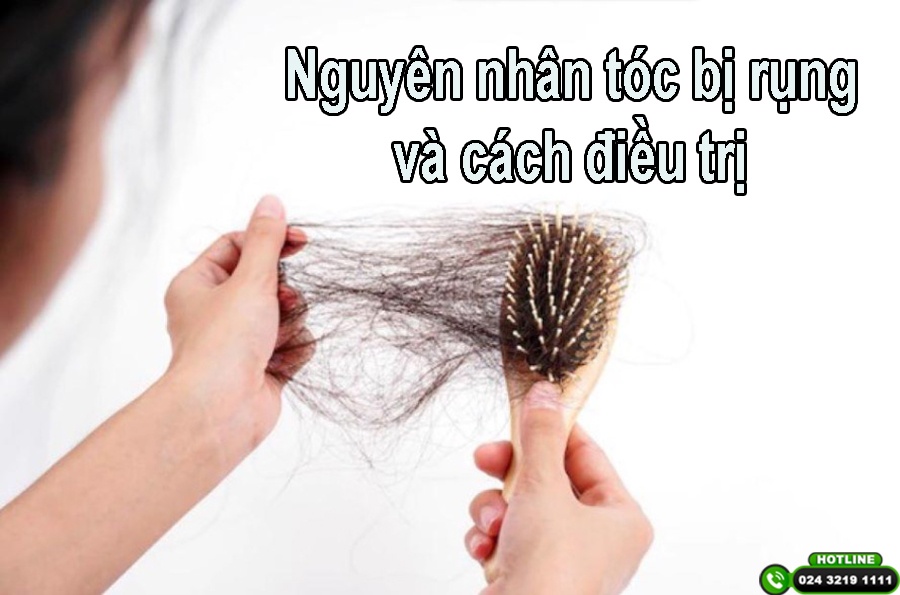 Nguyên nhân tóc bị rụng và cách điều trị – Bạn đã biết!