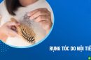 Hiểu đúng rụng tóc do nội tiết tố để điều trị hiệu quả