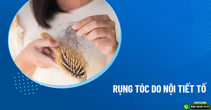 Hiểu đúng rụng tóc do nội tiết tố để điều trị hiệu quả