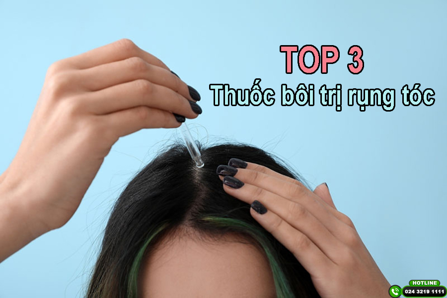 TOP 3 loại thuốc bôi trị rụng tóc bán chạy nhất hiện nay